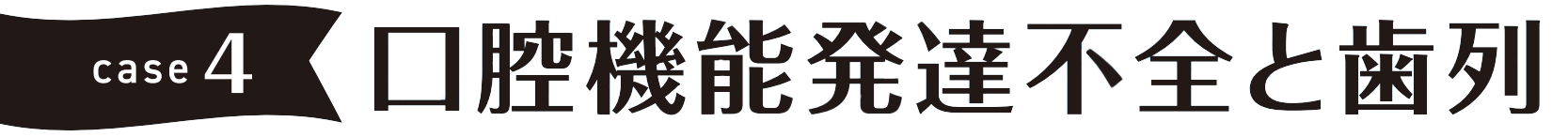 case4 口腔機能発達不全と歯列